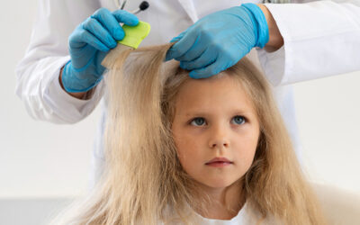 Alopecia infantil: causas y tipos