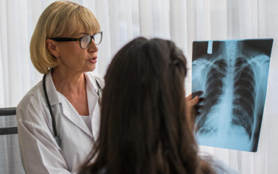 C&aacute;ncer de pulm&oacute;n en mujeres: diferencias respecto a los hombres