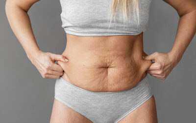Cómo tratar la diástasis abdominal después del parto, según un experto