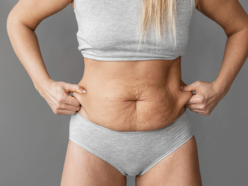 Cómo tratar la diástasis abdominal después del parto, según un experto Imagen33603D
