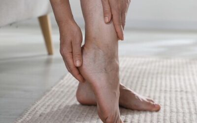 Piernas cansadas, pesadez e hinchazón: ¿qué señales advierten de que tu circulación no va bien?