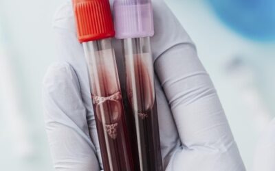 Asocian el rango bajo normal de hemoglobina a un mejor metabolismo de la glucosa, mejor salud cardiovascular y menos grasa en el hígado