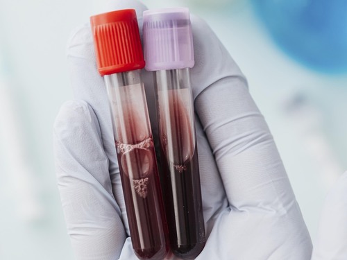 Asocian el rango bajo normal de hemoglobina a un mejor metabolismo de la glucosa, mejor salud cardiovascular y menos grasa en el hígado Imagen33942D