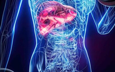 Hígado graso y riesgo cardíaco: el preocupante vínculo con la placa arterial inestable