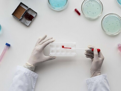 Récord de infecciones de transmisión sexual: Europa exige mejorar los diagnósticos y tratamientos más rápidos Imagen34258D