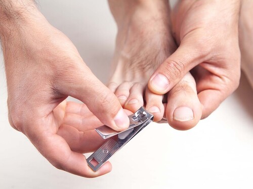 El error común al cortarse las uñas de los pies que puede costar caro a la salud Imagen34279D