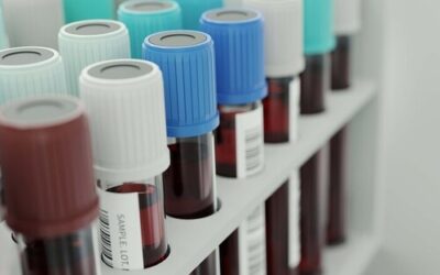 La razón por la que los médicos insisten en una analítica anual desde los 40 años