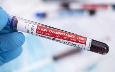 Un triple tratamiento elimina el VIH en macacos bebé