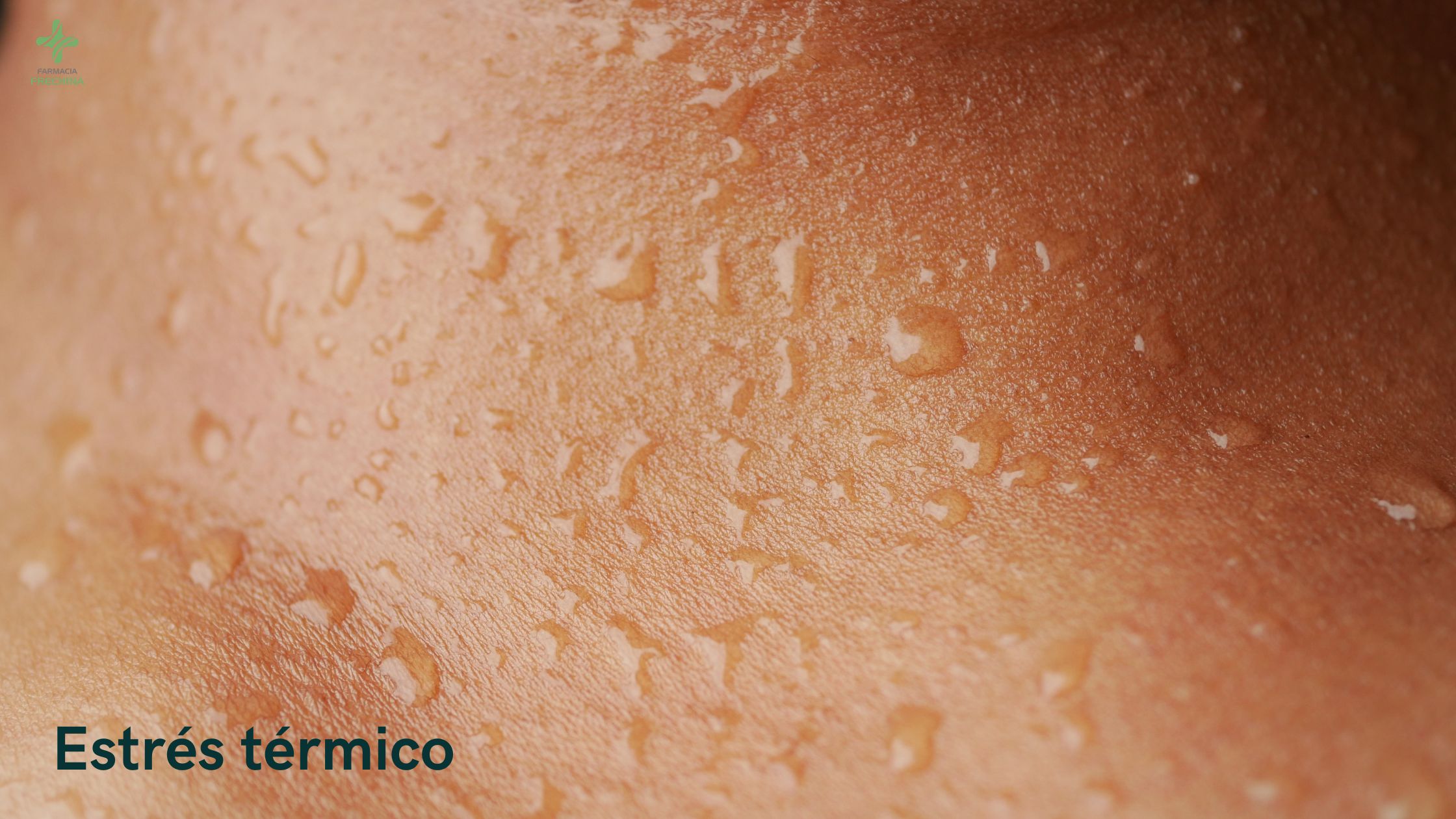 farmacia frechina sudoracion de la piel menopausia Farmacia Frechina Sudoracion De La Piel Menopausia