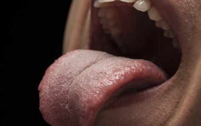Cómo entrenar la lengua para mejorar el sueño en pacientes con apnea