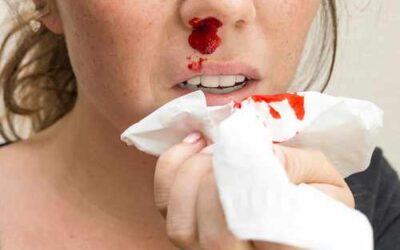 Sangrado nasal: las causas que pueden estar detrás de una hemorragia en la nariz